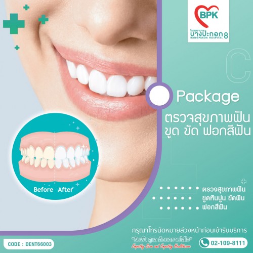 ตรวจสุขภาพฟัน - Package(C) ตรวจ ขูด ขัด ฟอกสีฟัน ที่โรงพยาบาลบางปะกอก 8 ตรวจสุขภาพฟัน - Package(C) ตรวจ ขูด ขัด ฟอกสีฟัน ที่โรงพยาบาลบางปะกอก 8